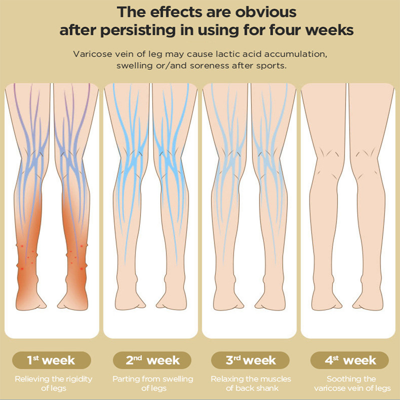 leg massager for DVT prevention